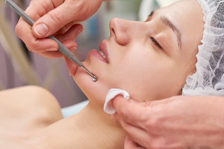 Blackhead removal store facial