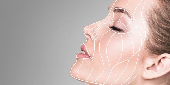 cheek lift with fillers