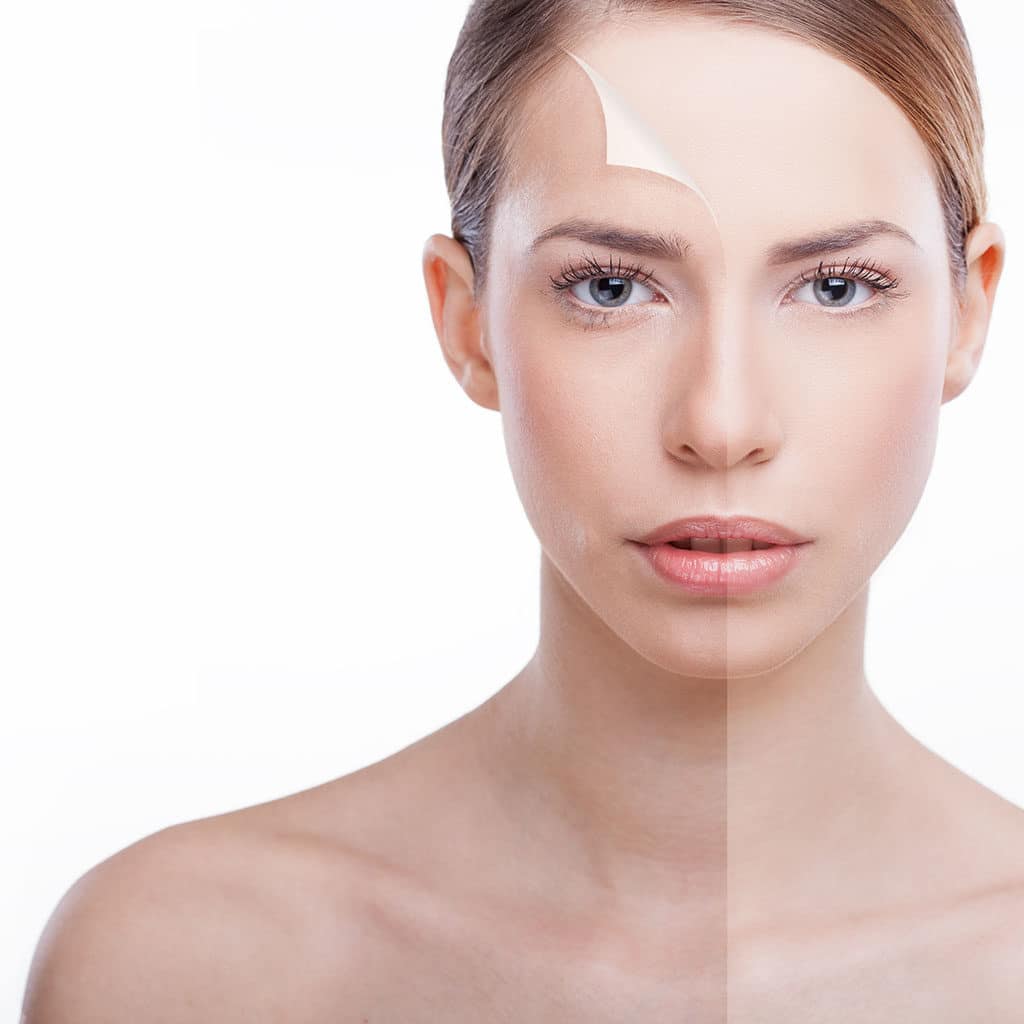 chemical peel1 1024x1024 1