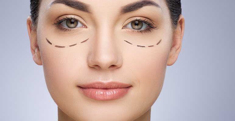 10 Most Effective Ways To Prevent And Hide Dark Circles 3