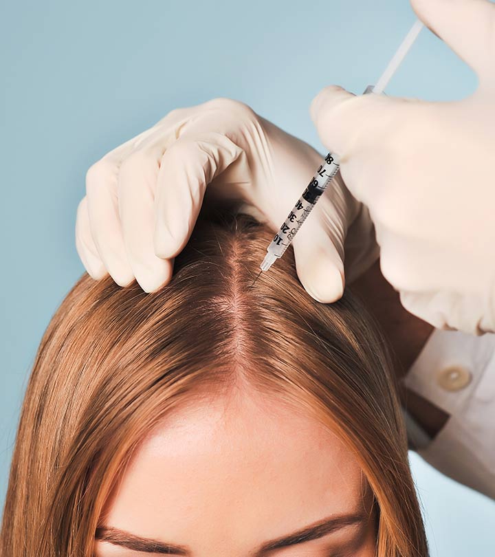 Mesotherapy-For-Hair-Growth-ss