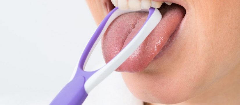 Tongue scraper