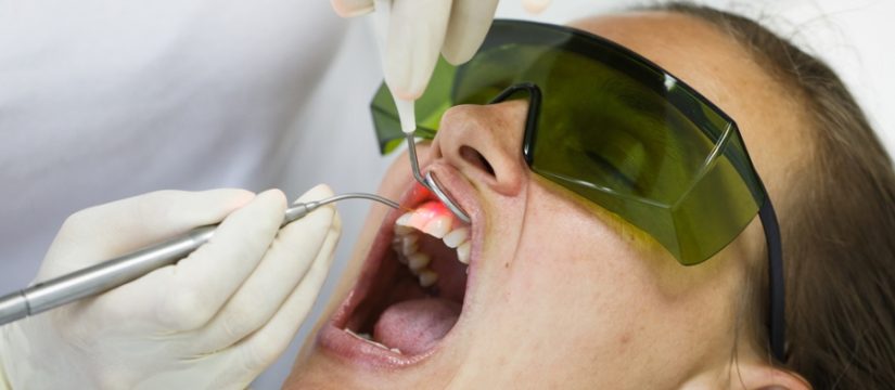 Laser Treatment for Gum Disease 1