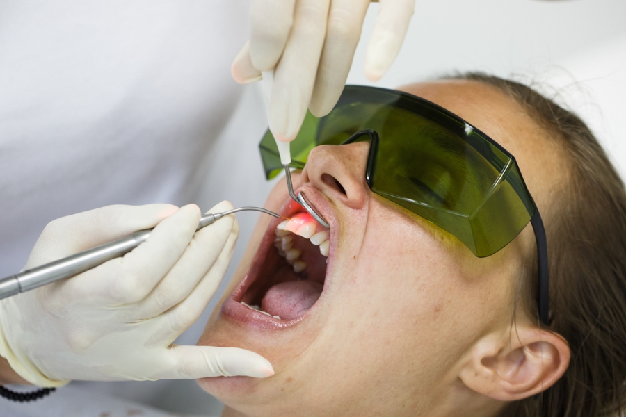 Laser Treatment for Gum Disease 1