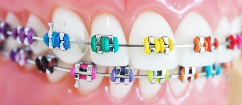 rainbow braces