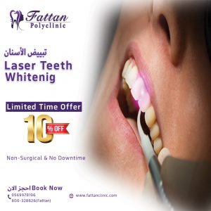 Fattan Polyclinic - Laser Teeth Whitening in Dubai
