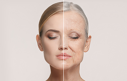 PRP treatment for wrinkles