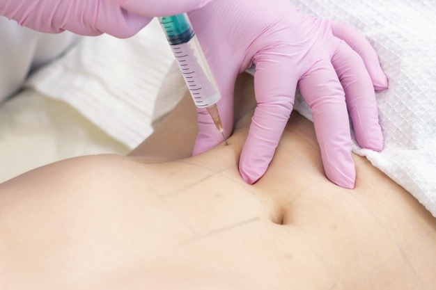 Lipolysis Treatment